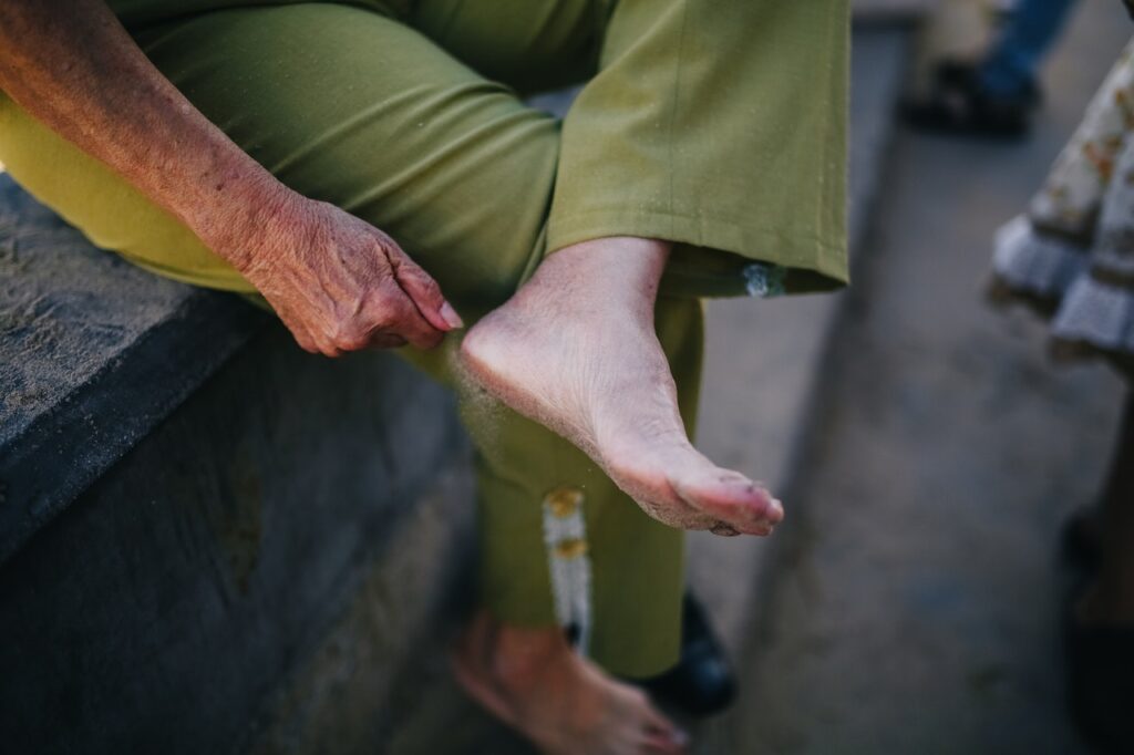 Foot Problems in the Elderly