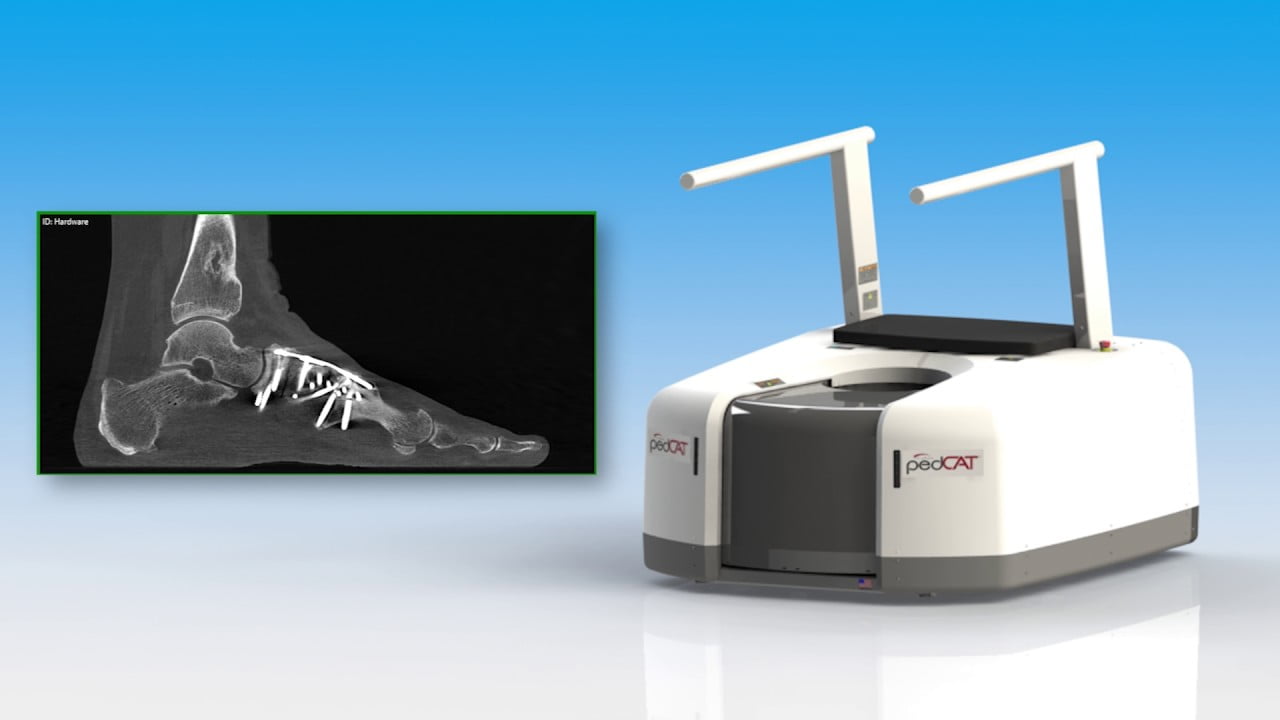 3d foot scan